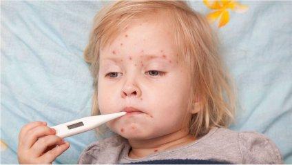 Обережно кір!