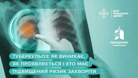 Туберкульоз: як виникає, як проявляється і хто має підвищений ризик захворіти